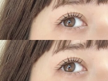 モア(Moi)/メーテルラッシュリフト