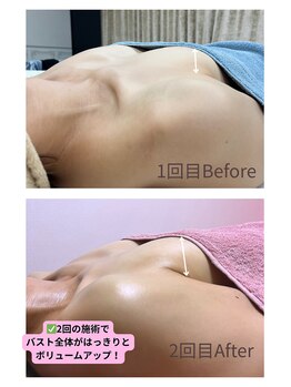 チュラ 大宮店(Chura)/【40代】バストアップ2回目@大宮