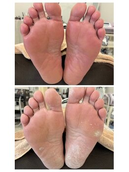 サロン ラディアンス(Salon Radiance)/パラフィンワックスフットケア☆