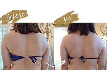 サロンハナ(Salon HANA)/二の腕と肩の印象が変わります