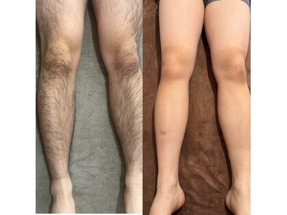 モアスリー(Moa3)の写真