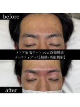 ユー 西船橋店(you)/ビフォーアフター写真