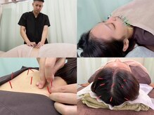 ふれあい整骨院の雰囲気（鍼灸・美容鍼・頭皮鍼になります。鍼施術はリピート率No.1です）