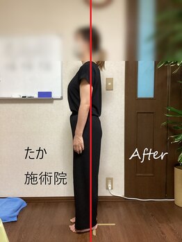 たか施術院/肩こり 背中の痛み 初回～２回目