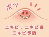 【あごニキビケア】顎や口周りのニキビ予防専用クーポン登場♪90分￥5,500