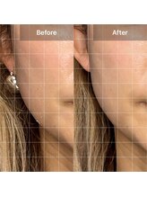 ハス(hasu.)/たるみ改善初回体験