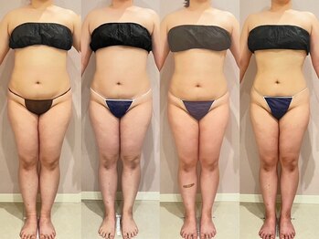 スローティ ラテ 旭川店/お腹-8.3センチ!体重-5.4kg