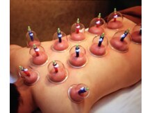 鴎迪足道 水道橋店/吸い玉中国伝統療法