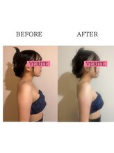 ワン ストレッチ(ONE stretch)/【姿勢改善】