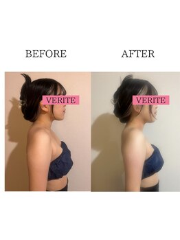 ワン ストレッチ(ONE stretch)/【姿勢改善】