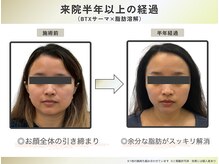 ナチュリ センター南院(NACHUL)の雰囲気（最新豊胸術★業界最高濃度の脂肪増加剤使用！コスパ最高）