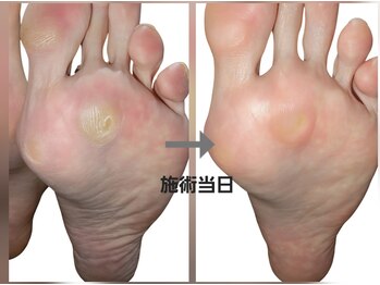 エーケーネイル(AKnail)/