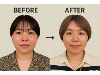 ケイビューティ(k-beauty)/ ハイパーナイフ/小顔コルギ