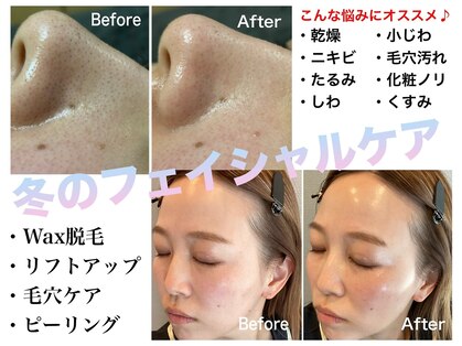 ルシェリ(Lecheri)の写真