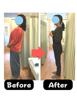 杉本接骨鍼灸院の写真/【更年期ダイエット専門】きちんと食べて痩せる◎なぜ痩せないか「原因がわかる」体質チェック＋体験施術