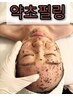 よもぎ蒸し＆韓国産ハーブピーリング肌荒れ撃退！つるつるお肌に