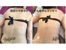 サロンハナ(Salon HANA)の雰囲気(デコルテふっくら背中と二の腕肩回りがスッキリ!若々しい背中に)