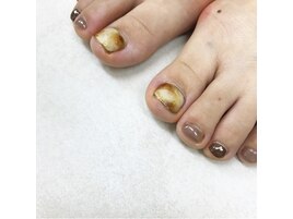 フットシェラックネイル