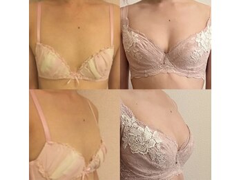 メデル(MEDEL)/ビフォーアフター