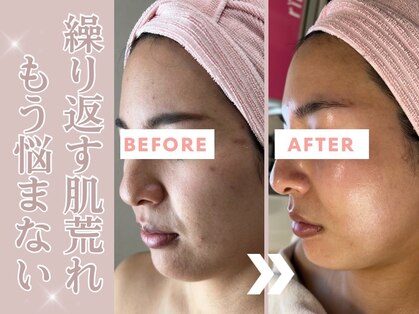 リール(rire)の写真