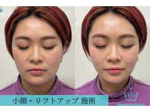 リメイクビューティークリニック(REMAKE BEAUTY CLINIC)/【施術症例】オチャンパッケージ