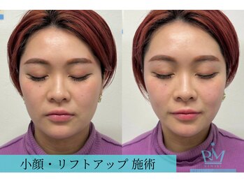 リメイクビューティークリニック(REMAKE BEAUTY CLINIC)/【施術症例】オチャンパッケージ