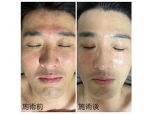 ゾーンビューティーハウス 松戸店(ZONE BEAUTY HOUSE)の雰囲気（当店ではメンズに特化した 肌質改善クーポン有 お試し頂けます♪）