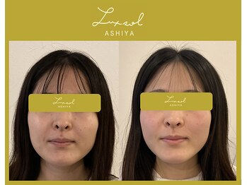 ルク ソル(Luxsol)/オリジナル深層リンパマッサージ