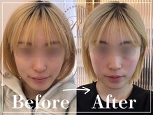 R-1ビューティーサロン 表参道/Before＆After