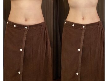 バーテックスキー(Vertexkey)/お腹スッキリしただけで別人