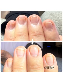 ミリアネイル 成城(Miliea nail)/