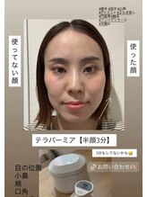 ヨサパーク リアン(YOSA PARK Lien)/私のbefore→after テラパーミア