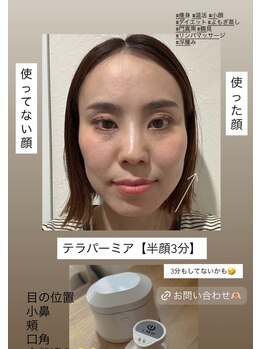 ヨサパーク リアン(YOSA PARK Lien)/私のbefore→after テラパーミア