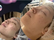 フォト トリートメント シエル(ciel)