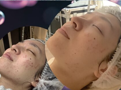 フォト トリートメント シエル(ciel)の写真