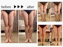 スラン(Slan)/美脚筋膜リリース