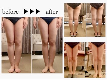 スラン(Slan)/美脚筋膜リリース