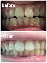 プラチナムビューティー 横須賀店/ビフォーアフター