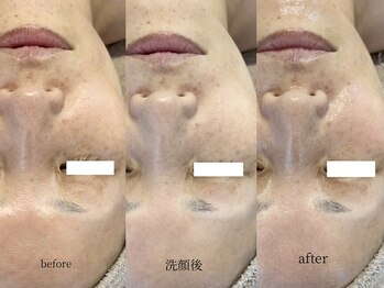 ヒュウ(hue.)/韓国発最新肌管理[セルマン]