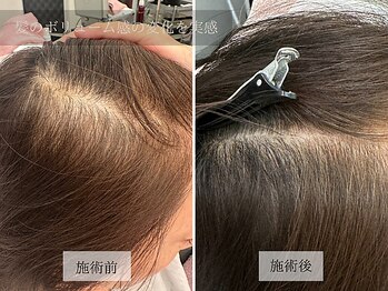 ル キヤ アイスペシャリテ ハービスENT店/【ビフォーアフター】育毛促進