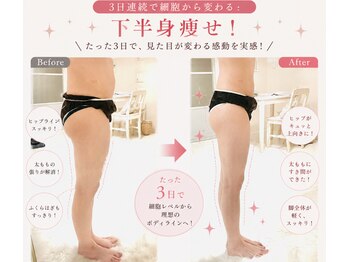 ヨサパーク グリーン(YOSA PARK 緑 green)の写真/マンツーマン施術でお悩みに徹底アタック。よもぎ蒸し×リンパのW施術で痩デトックスしながら健康美を