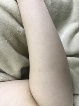 ナノハナ/鹿沼市本格脱毛の美容室ナノハナ