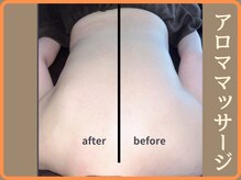 ニース(NICE)/施術１回＊腰痛＊ガチガチ腰痛