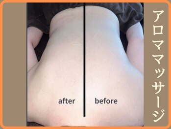 ニース(NICE)/施術1回*腰痛*ガチガチ腰痛