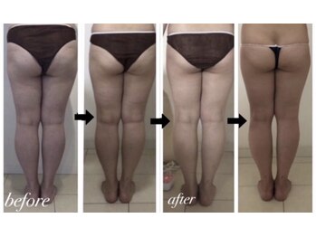 美人バスト 川崎店/【痩身・ダイエット】 川崎/脚☆