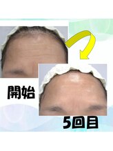 フェリス.ディア(Feliz.Dia)/【ビフォーアフター6】