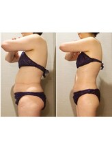 エイジングケア専門サロン サンク(thanq)/歪み太り・むくみ太りケア