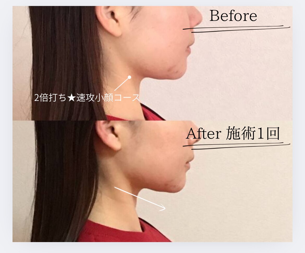 本通駅でEMSが人気のエステサロン｜ホットペッパービューティー