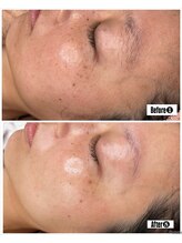 ダチュラ(Da'Chura)/シルクスキン