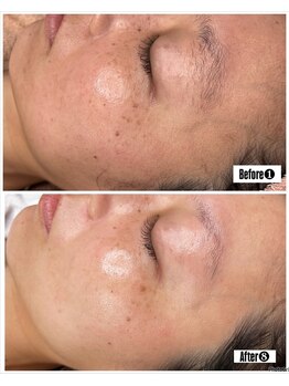 ダチュラ(Da'Chura)/シルクスキン